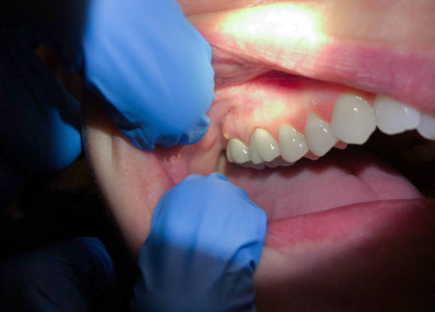 Best Walk-In Emergency Dentist in Lmerton, PA